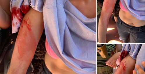 Grupo de hombres agrede a mujeres estudiantes de la UNAM en CU durante movilización feminista